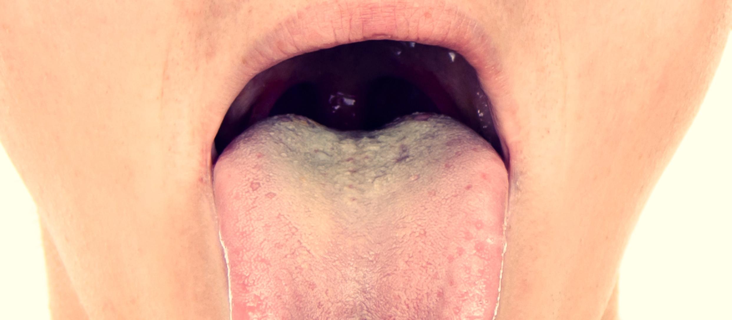 open mouth