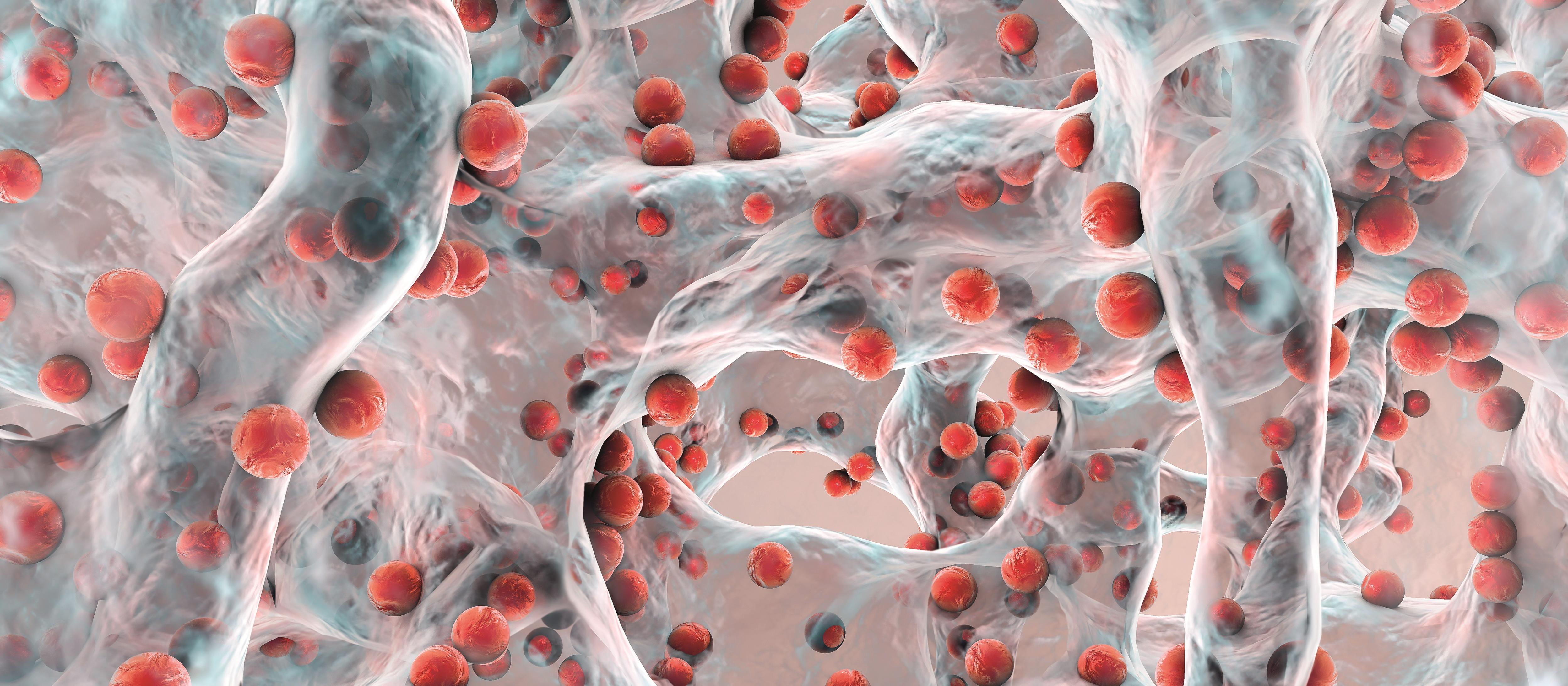 Biofilm of antibiotic resistant bacteria