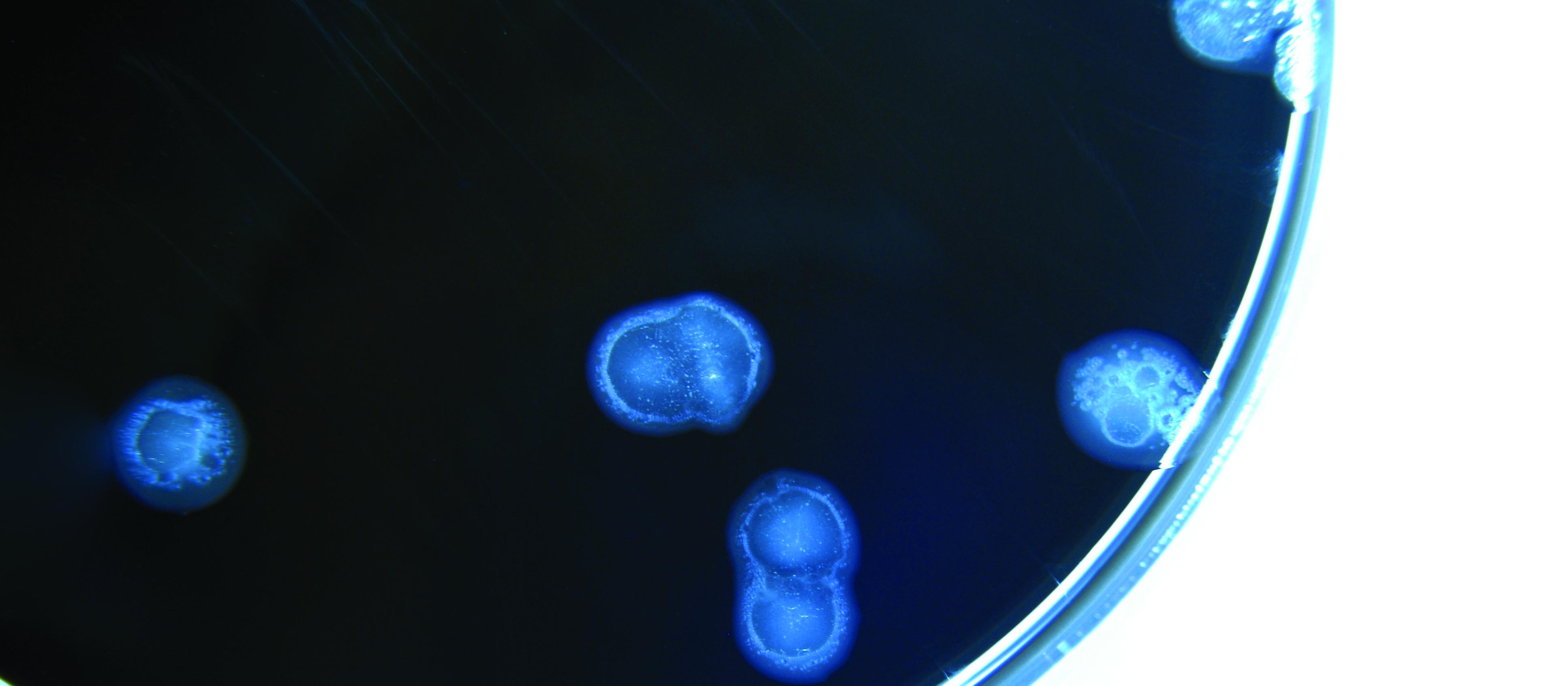 Campylobacter in petrie dish 