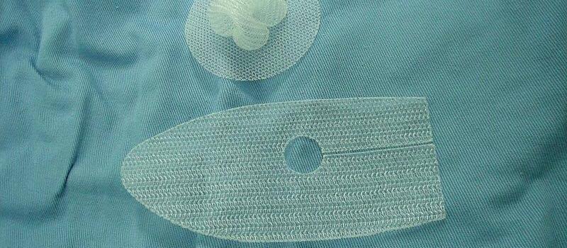Credit: Doctorofcm - https://commons.wikimedia.org/wiki/File:Hernia_mesh_1.jpg, CC BY-SA 3.0, https://en.wikipedia.org/w/index.php?curid=54003631