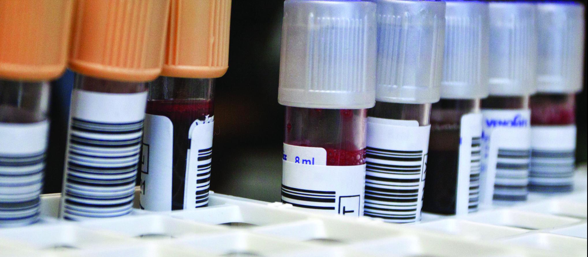 Test tubes