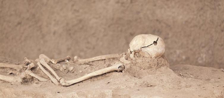 Trepanation