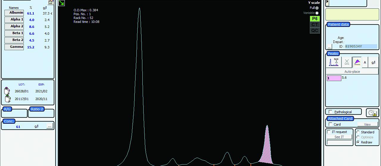 Electrophoretogram