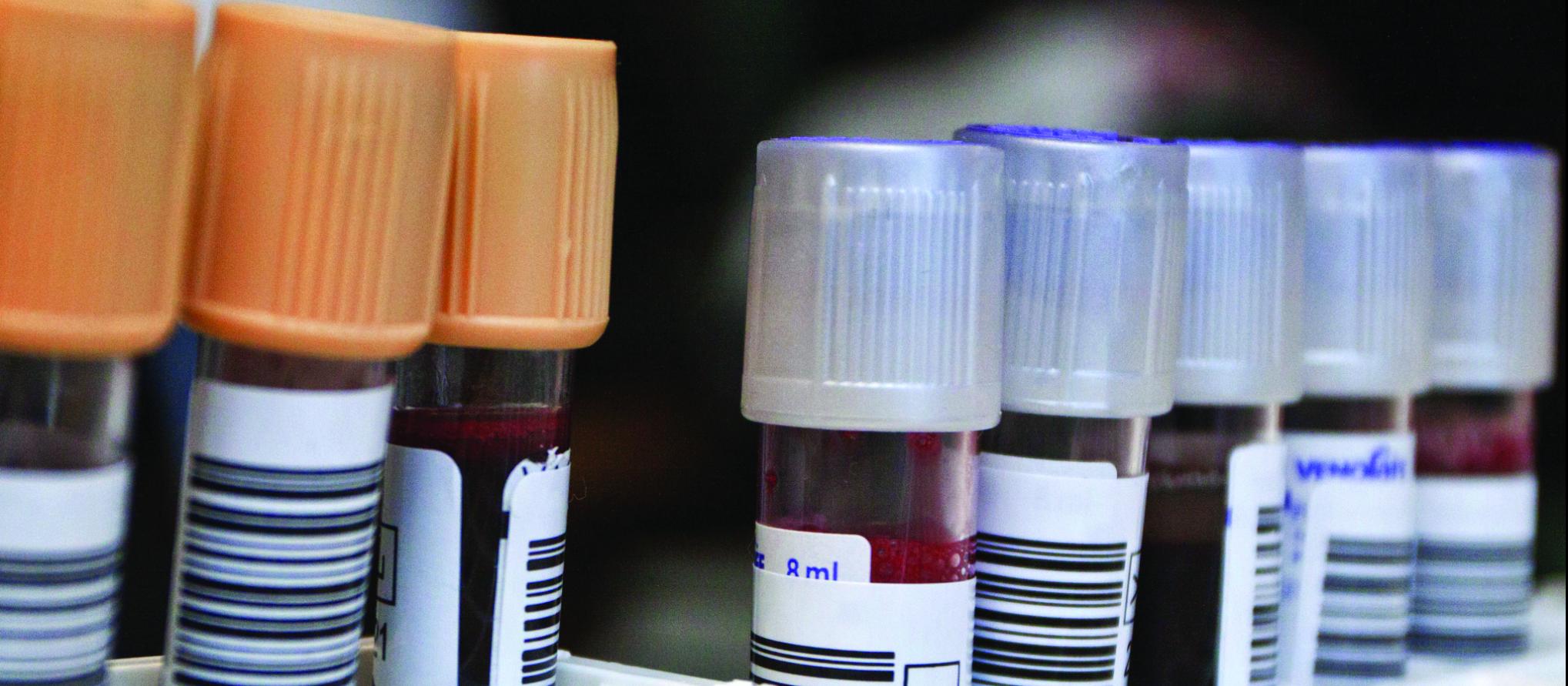 test tubes