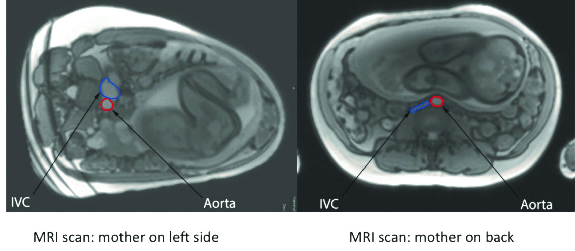 MRI image