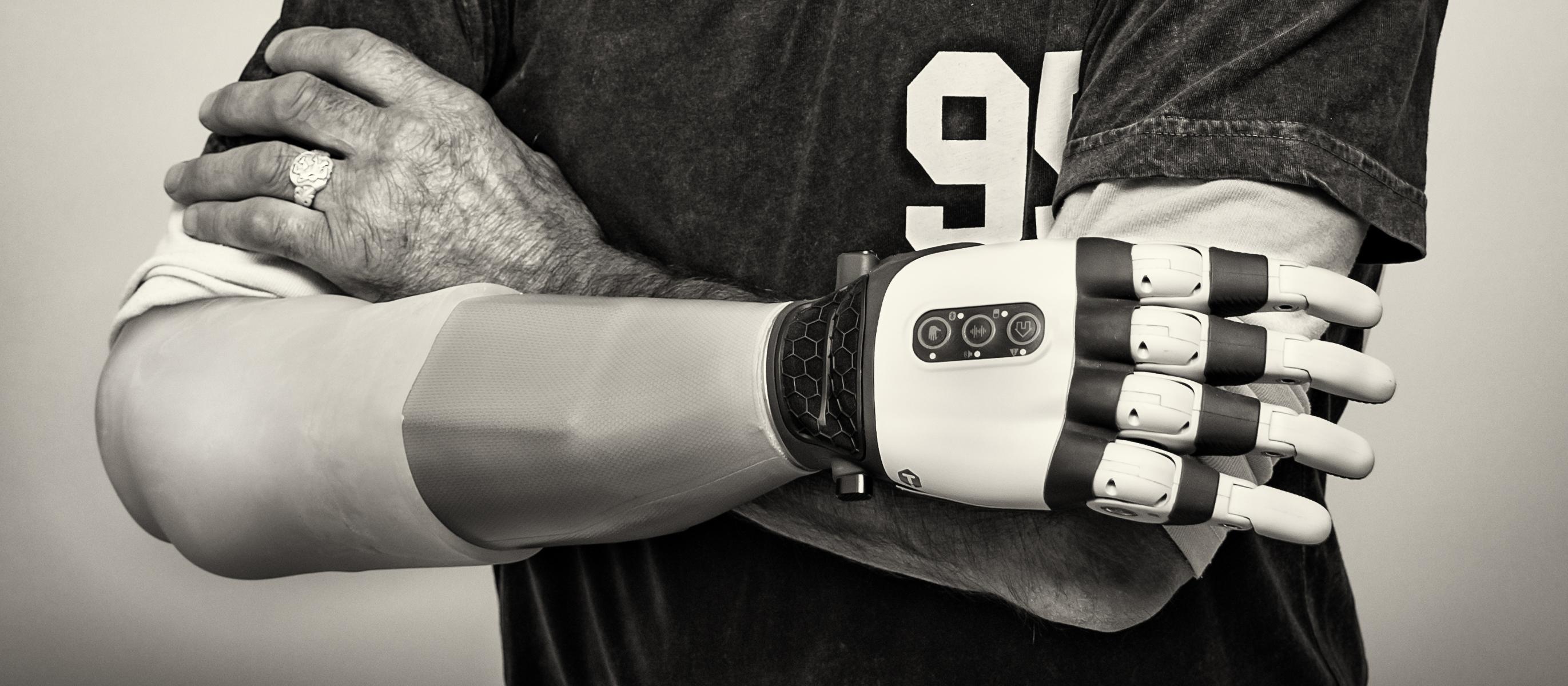 Artificial limb