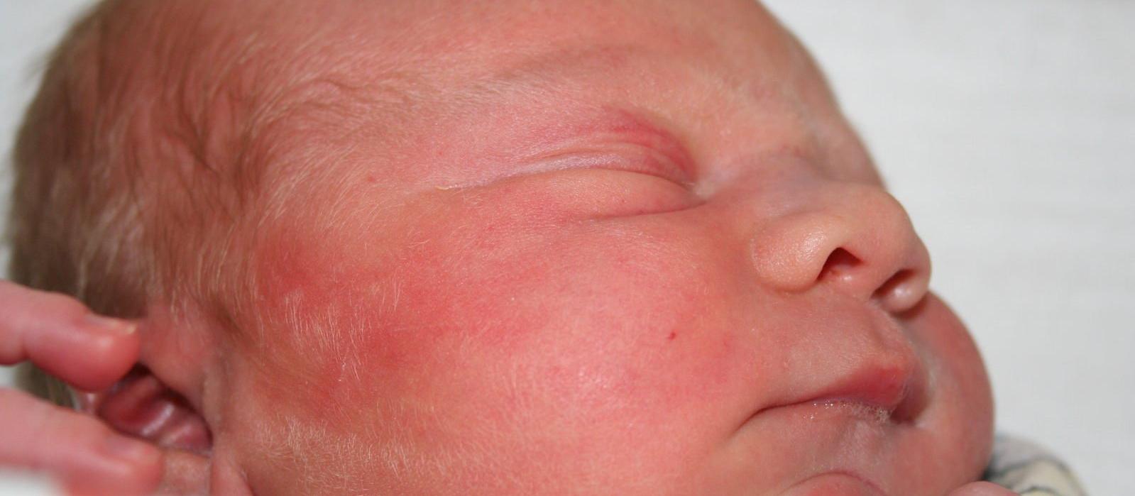 Newborn baby