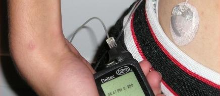 Insulin pump 2