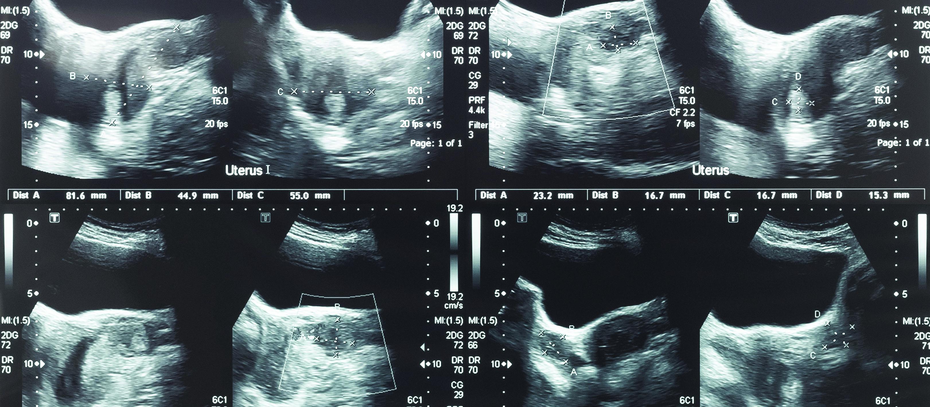 Scan