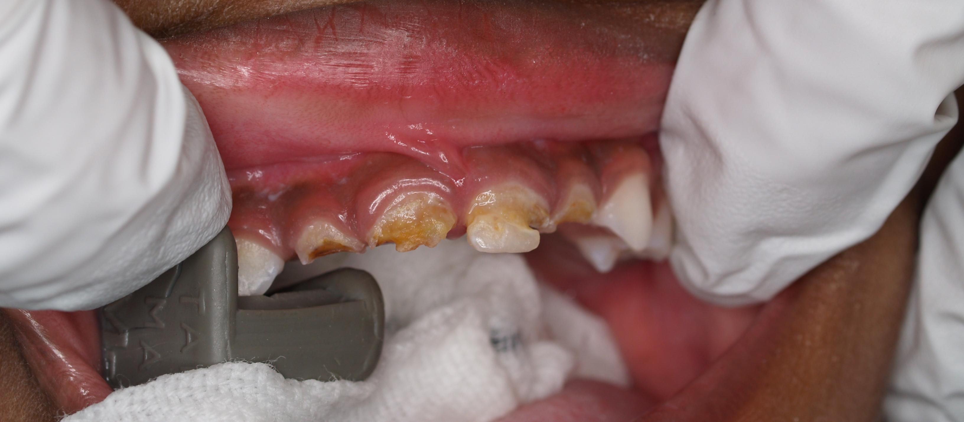 Dental, Teeth