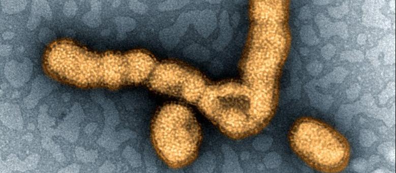 Flu