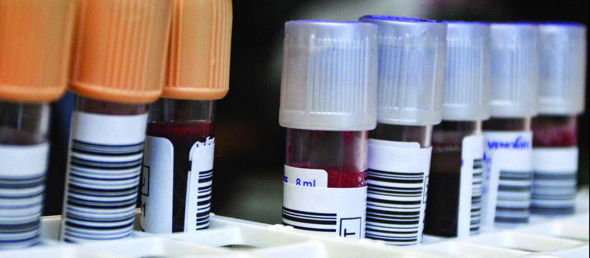 Test tubes with blood