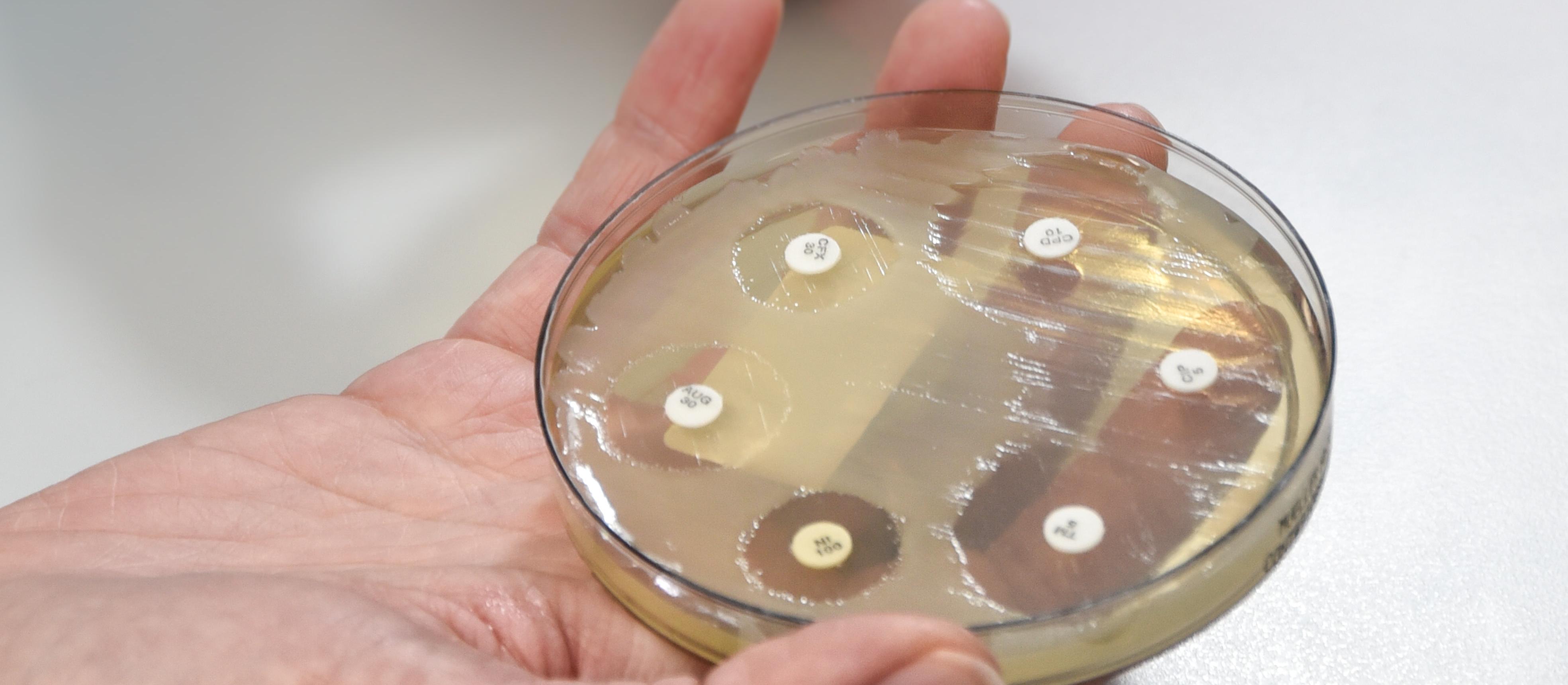 Bugs in the lab