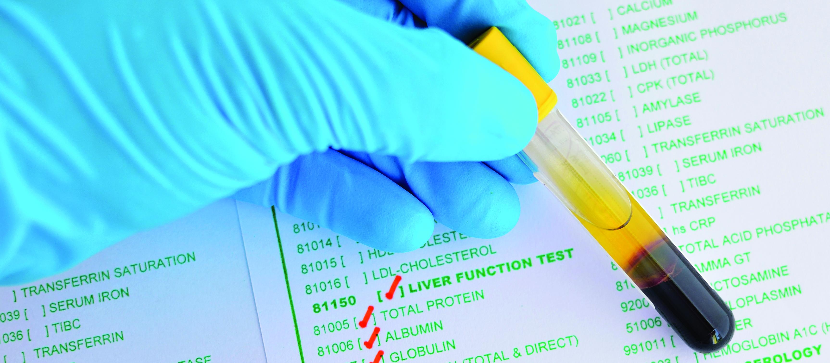 Liver function tests