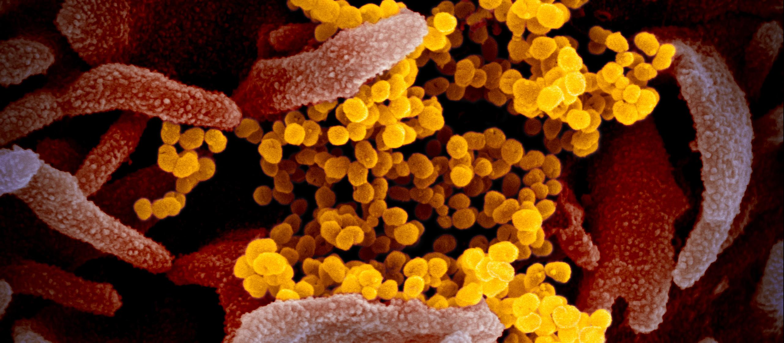 Novel Coronavirus SARS-CoV-2