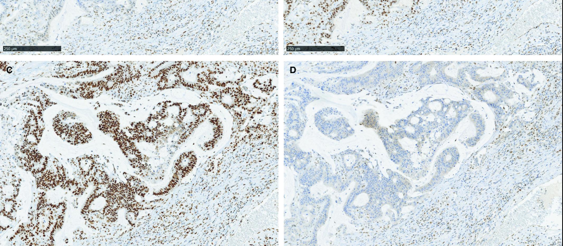 Genetic medicine, immunohistochemical