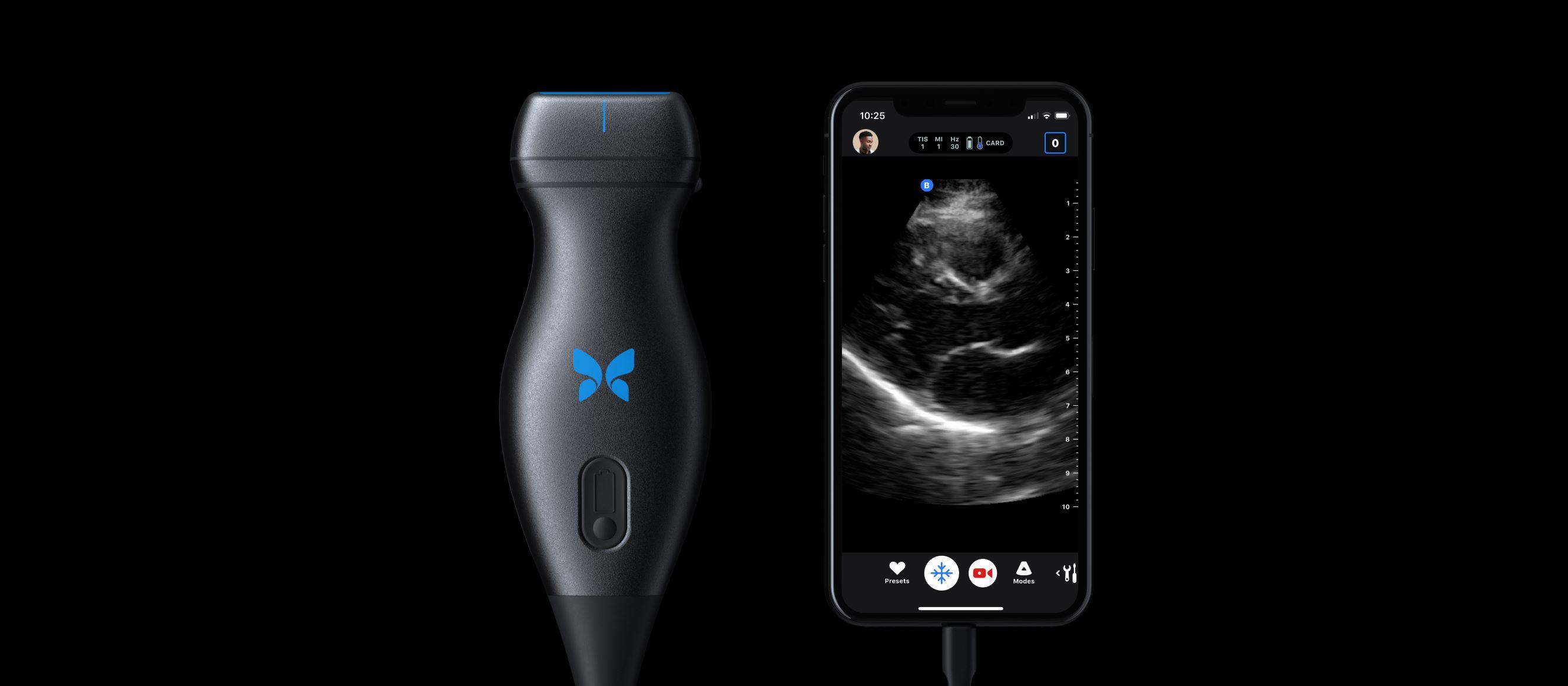 Butterfly IQ portable ultrasound