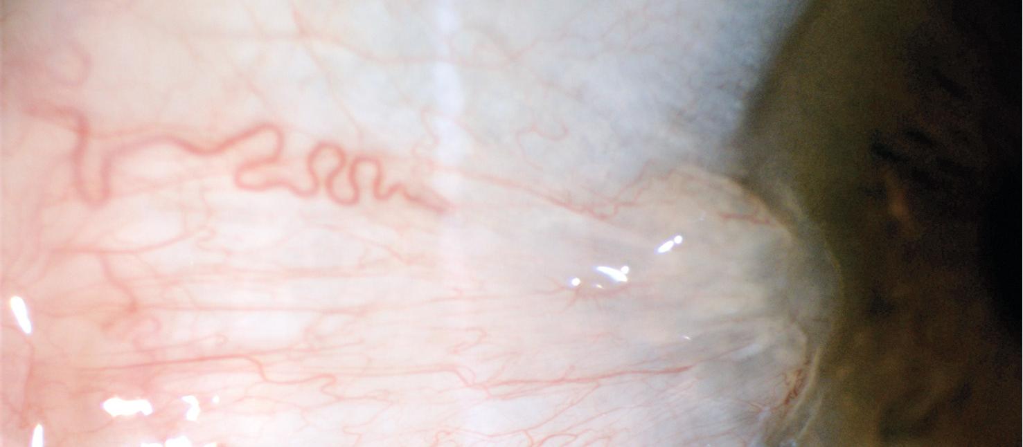 Eye health figure 1 (030221)