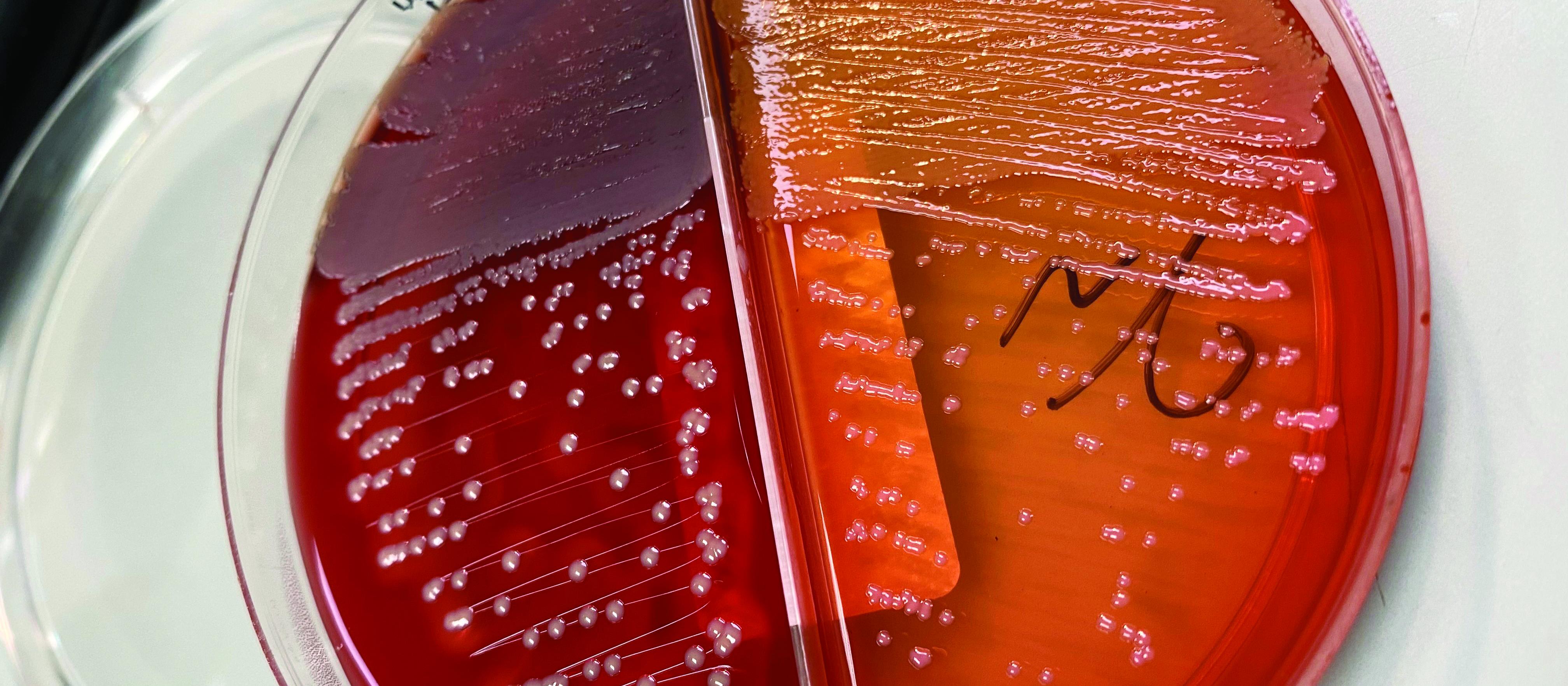 Wound swab culture
