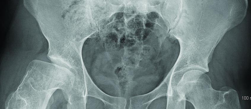 Sports Medicine figure, Hip and groin