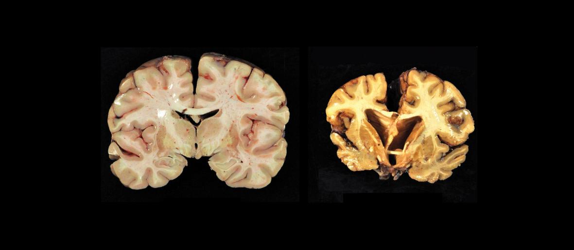 Sports-medicine_brain