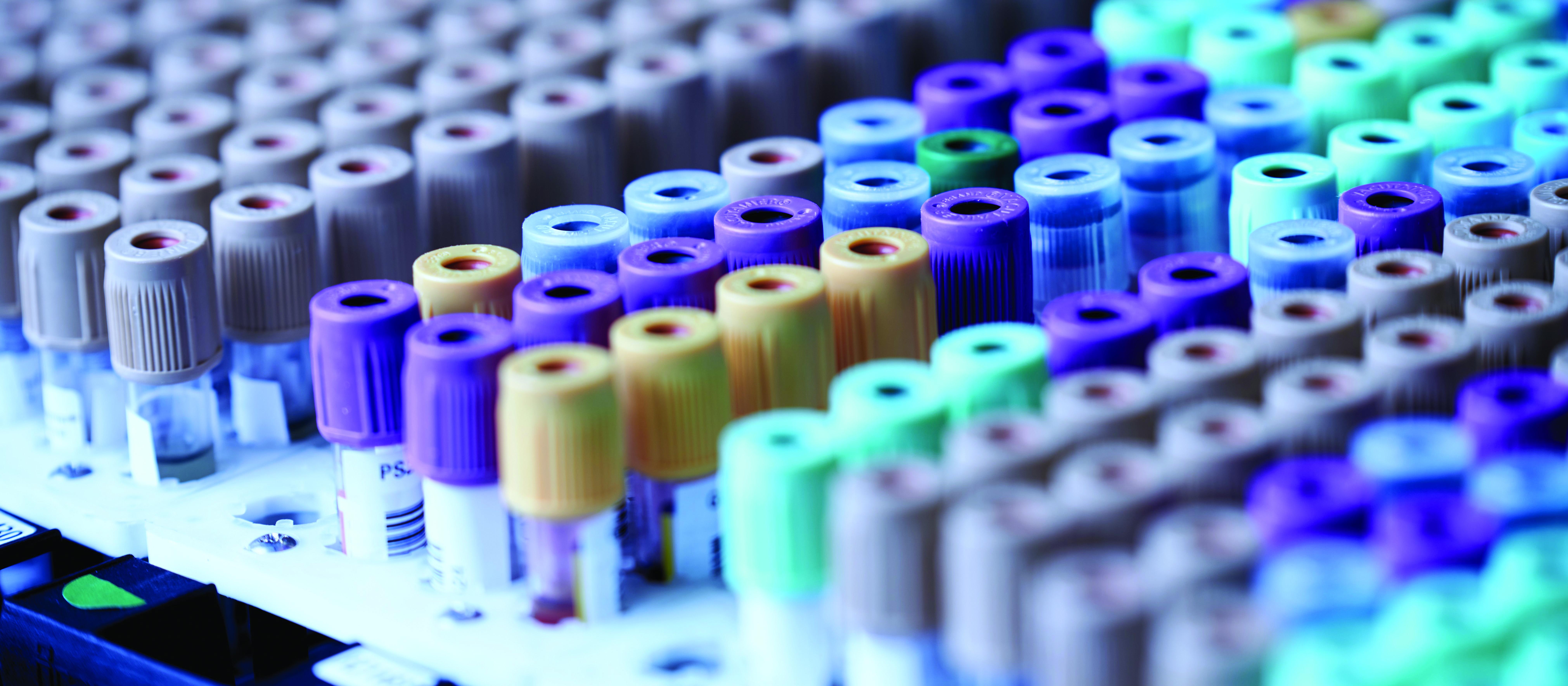 Blood test