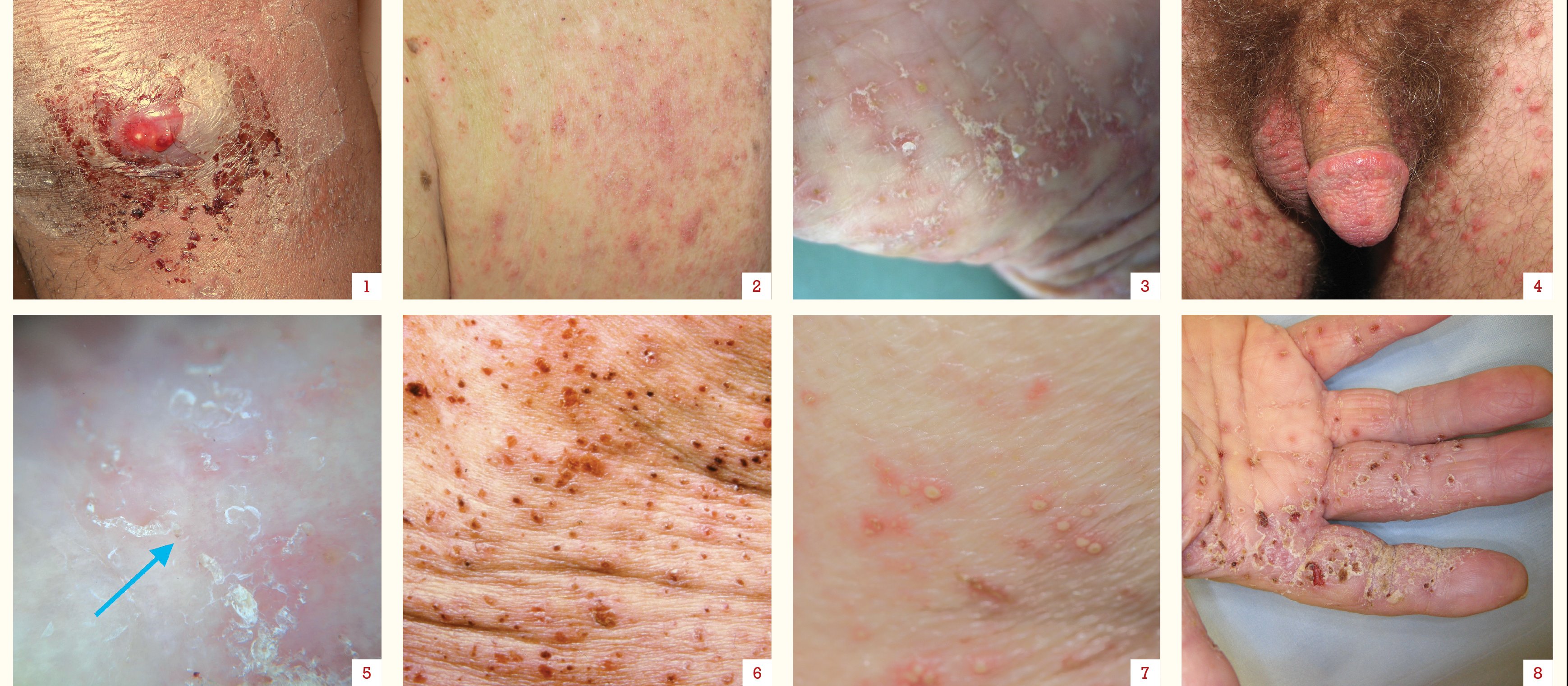Dermatology July 21