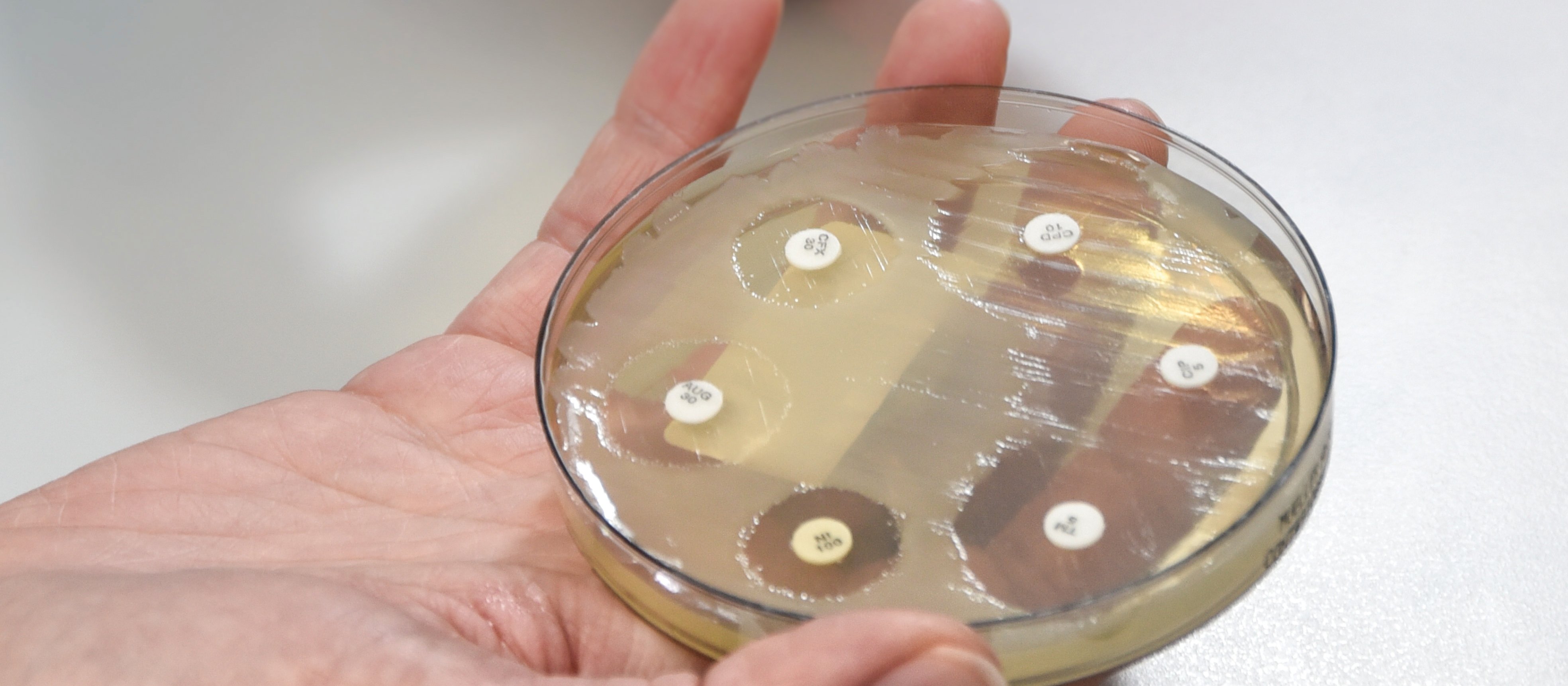 A zone of no growth around an antibiotic-impregnated disc demonstrates a susceptible organism