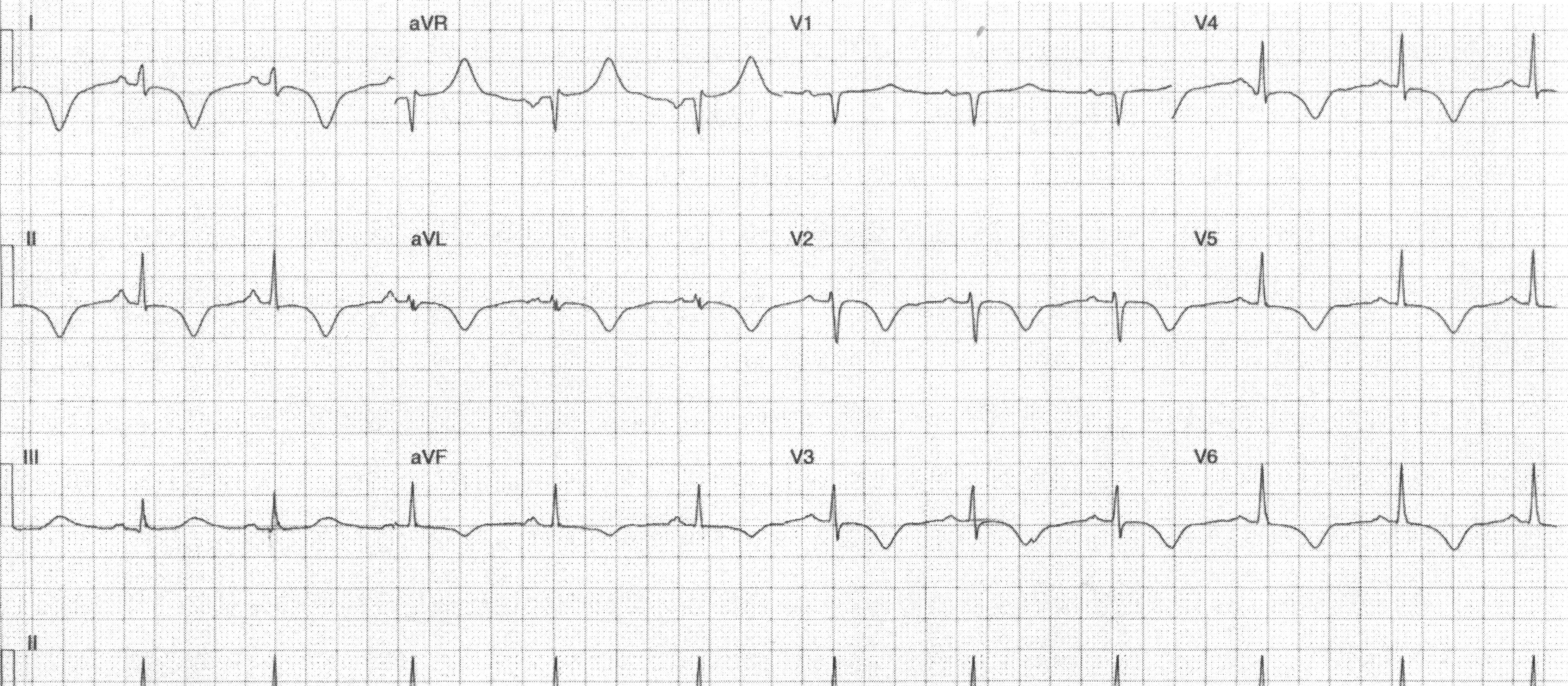 Heartbeat_ECG