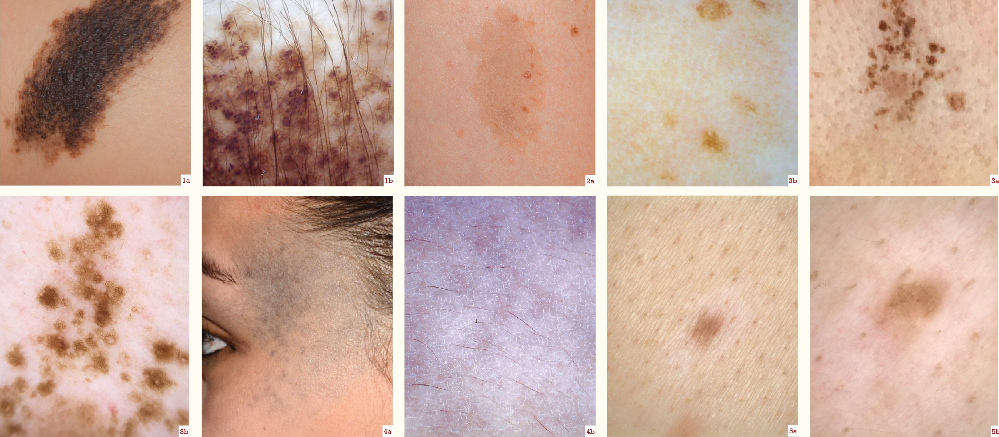 Dermatology Sept