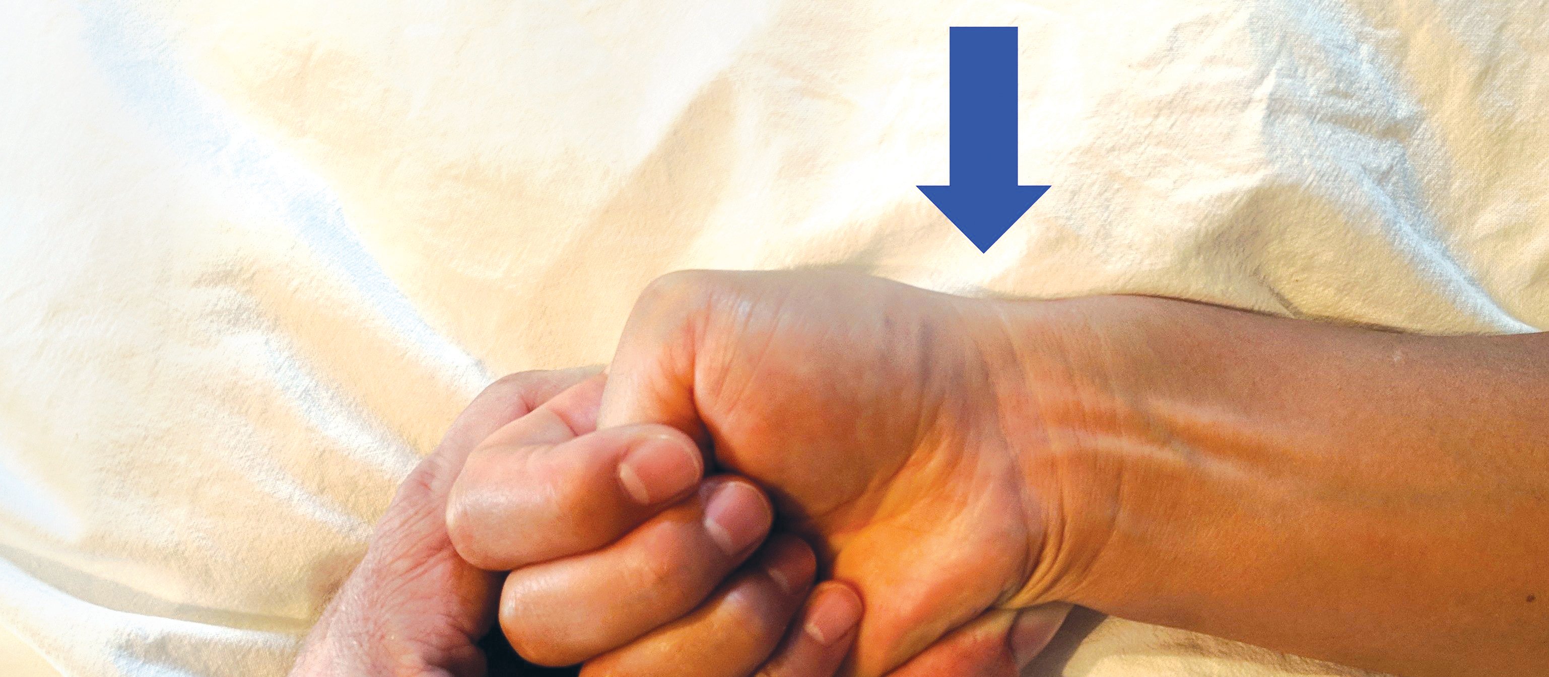 Wrist injury Sports Medicine Figure 1