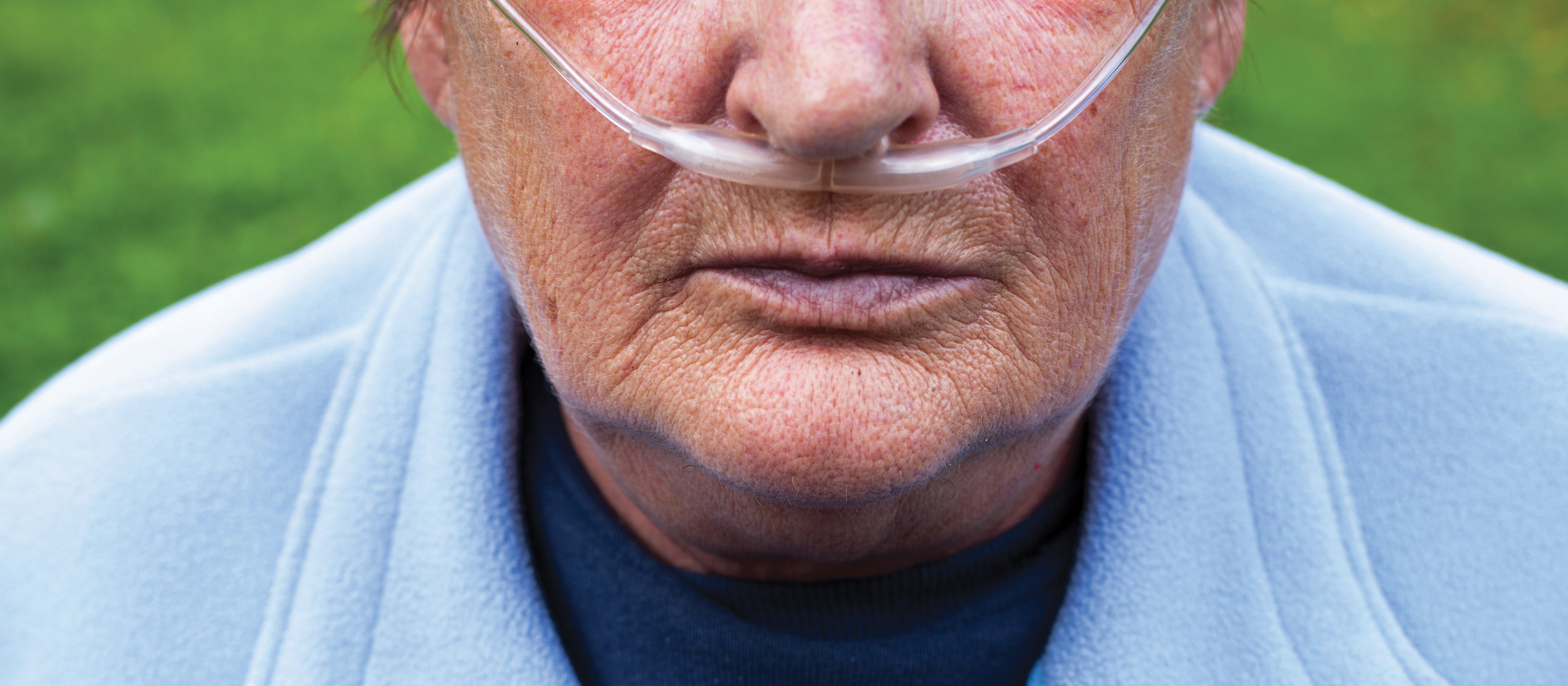 urbans78 istock Maori woman COPD tube in nose_RGB.jpg