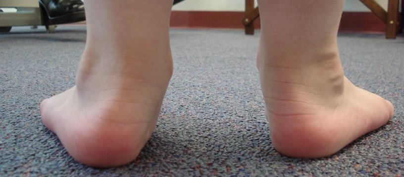 PEARLS 693 Flat feet