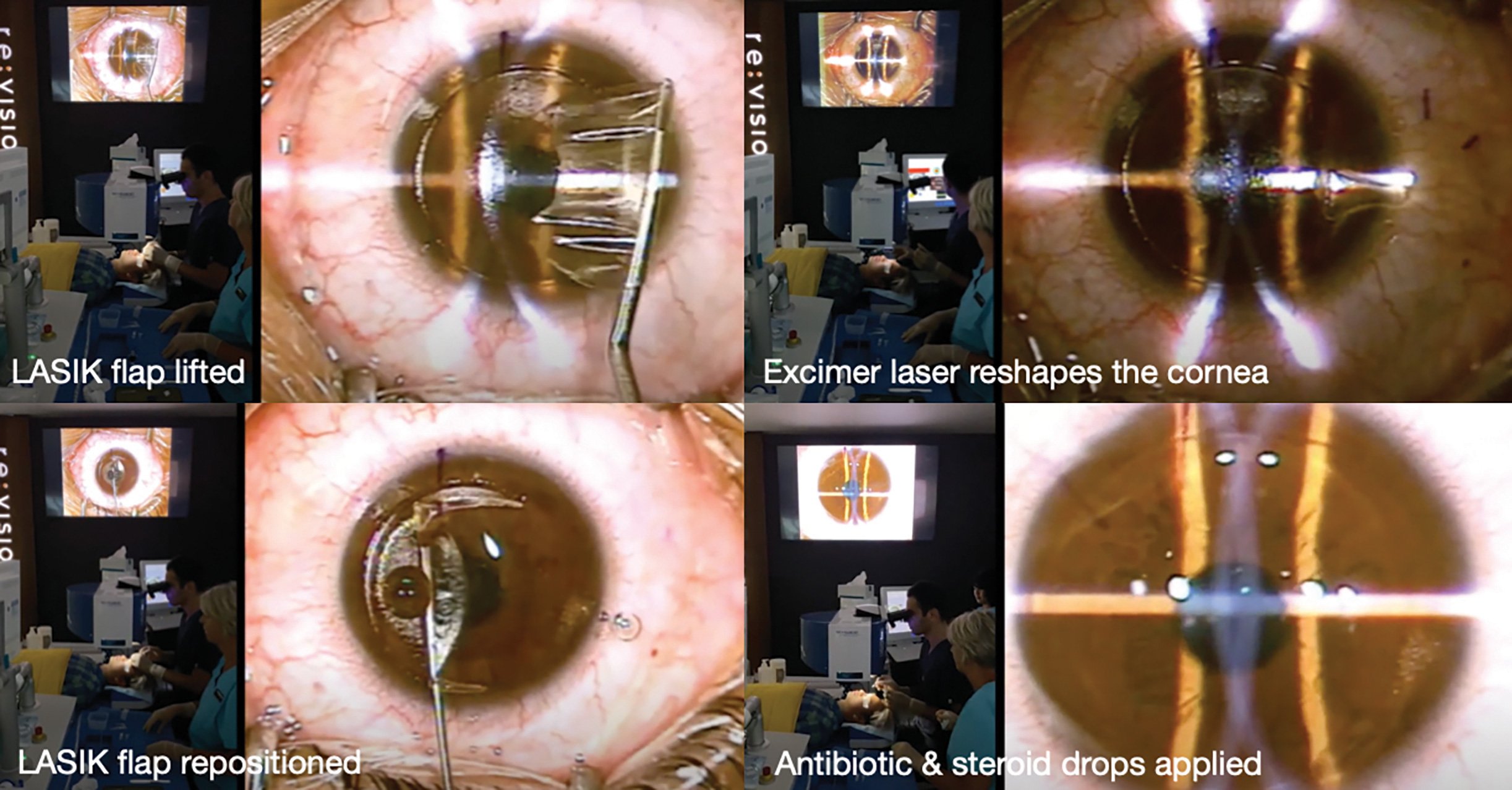 Eye Health Figure 1