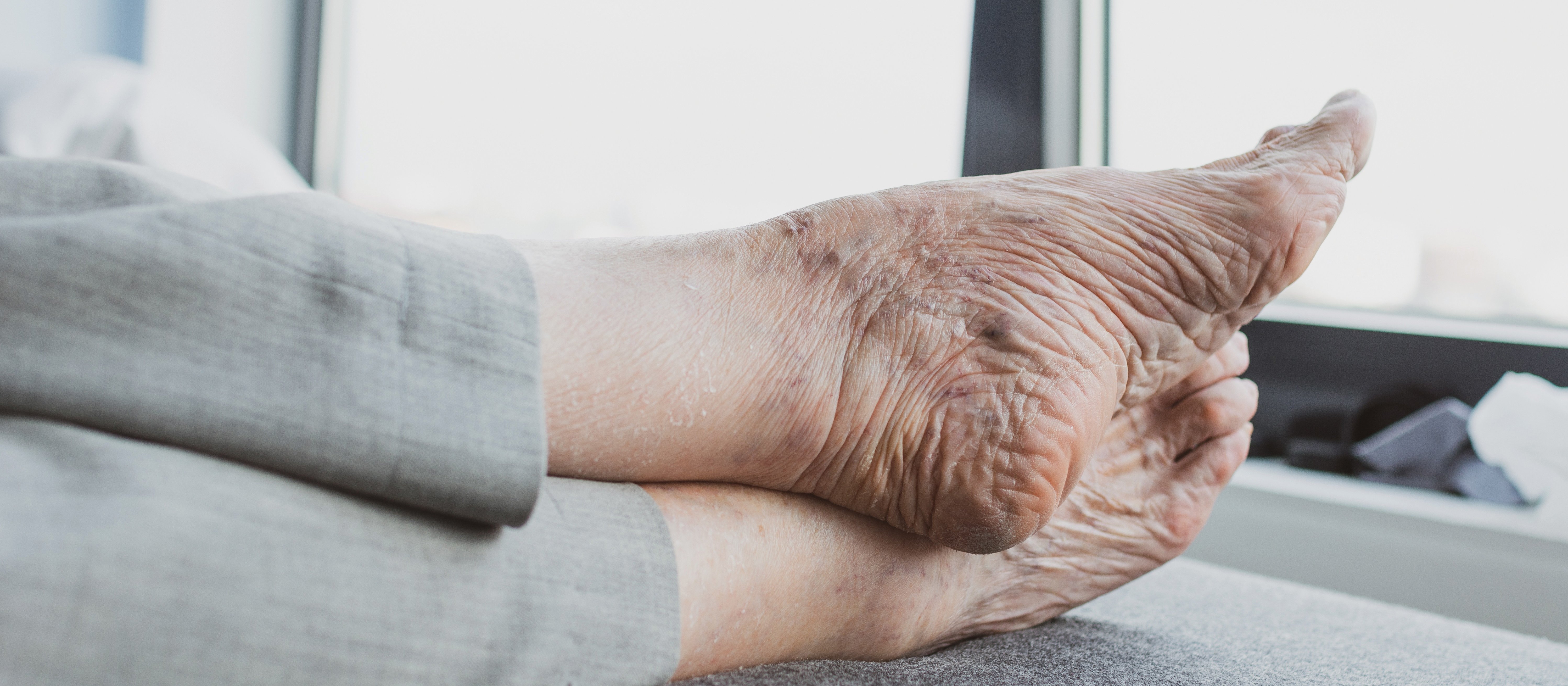Old feet