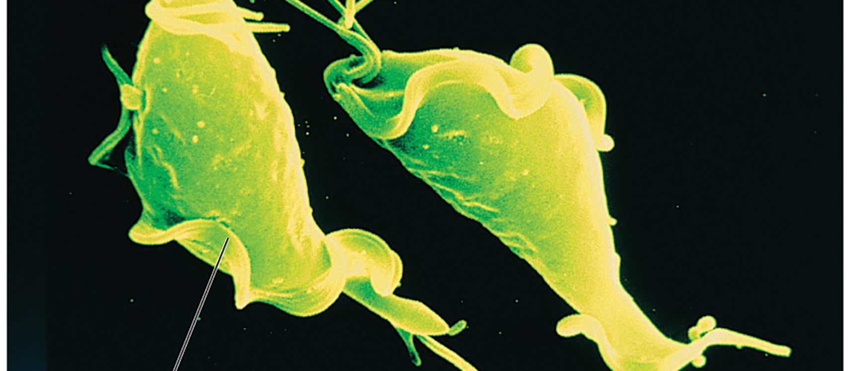 Trichomonas vaginalis