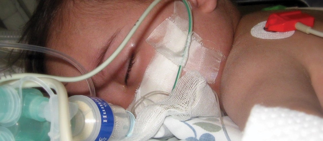 Unwell unvaccinated child