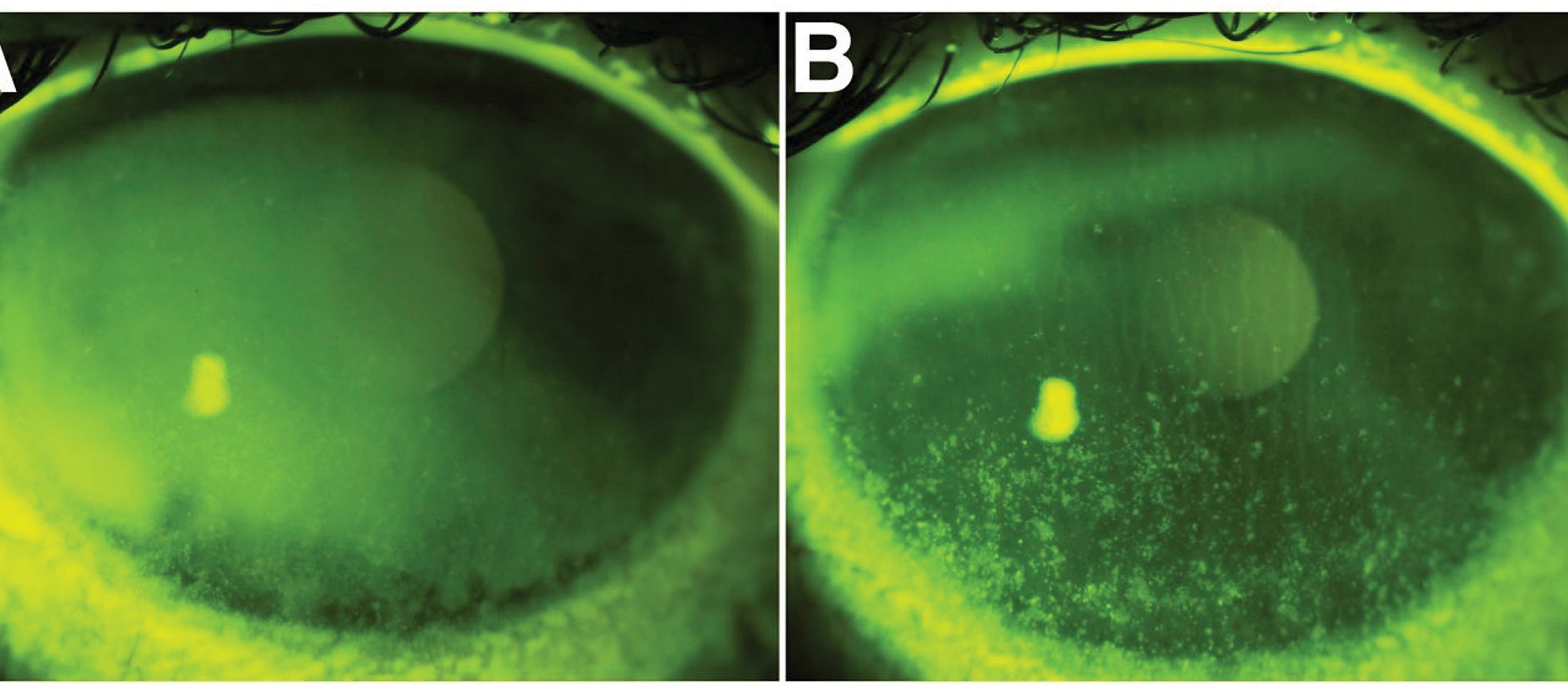 Eye health
