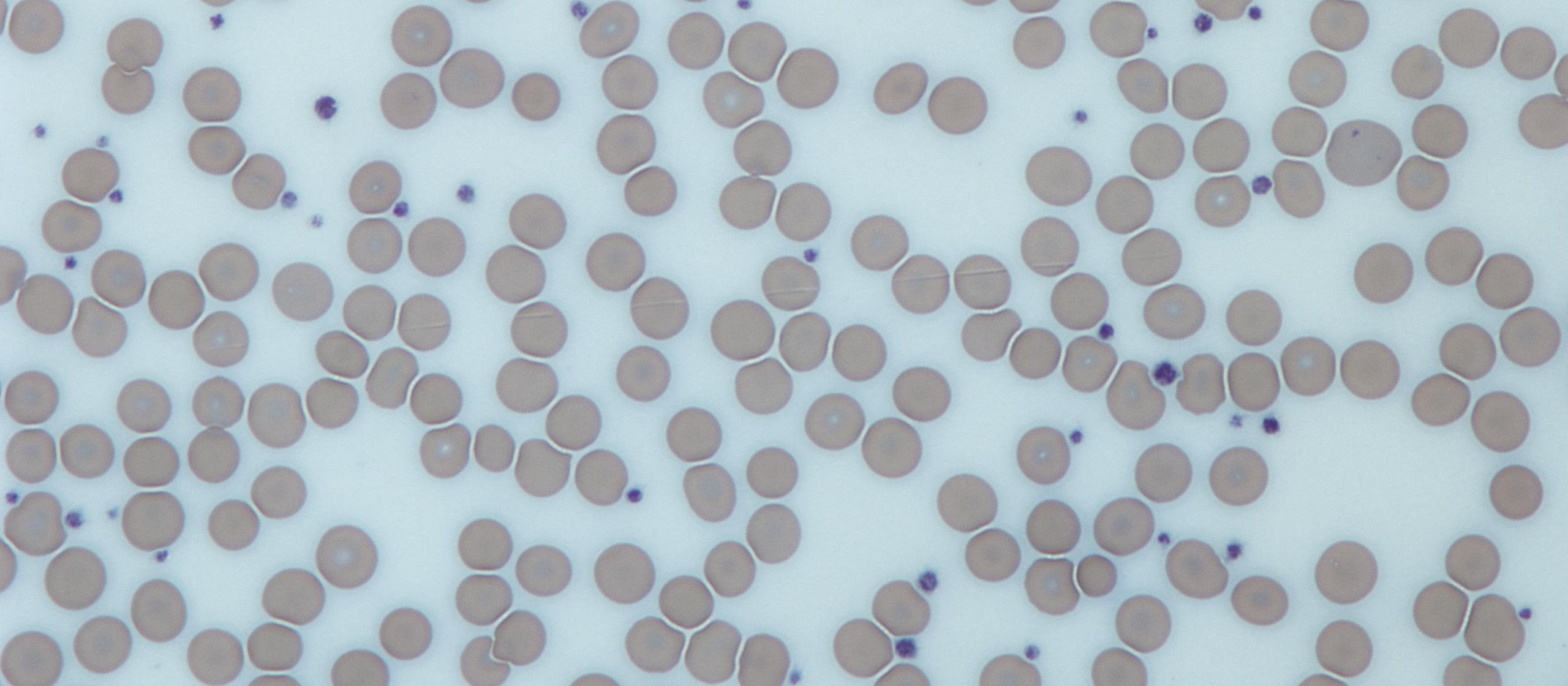 Platelets