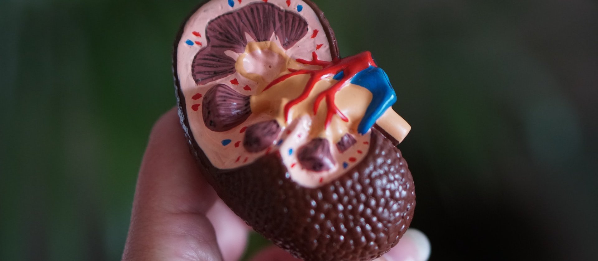 Kidney