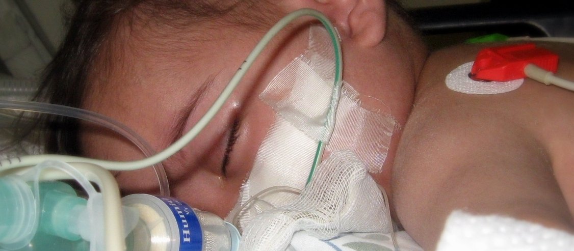 Pneumococcal disease