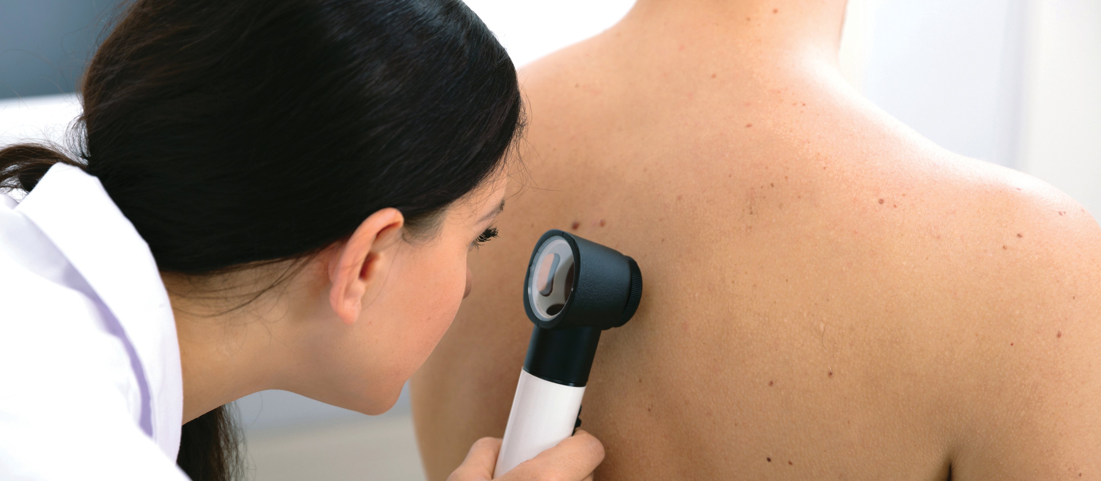 Skin Check CR Andrey Popov on iStock