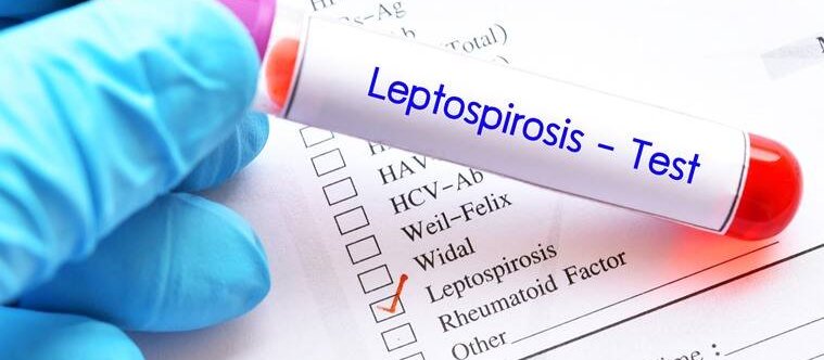 The Auckland Regional Public Health Service says there has been an increase in leptospirosis notifications over the past two weeks which may be linked to the recent weather events [Image: LDR]