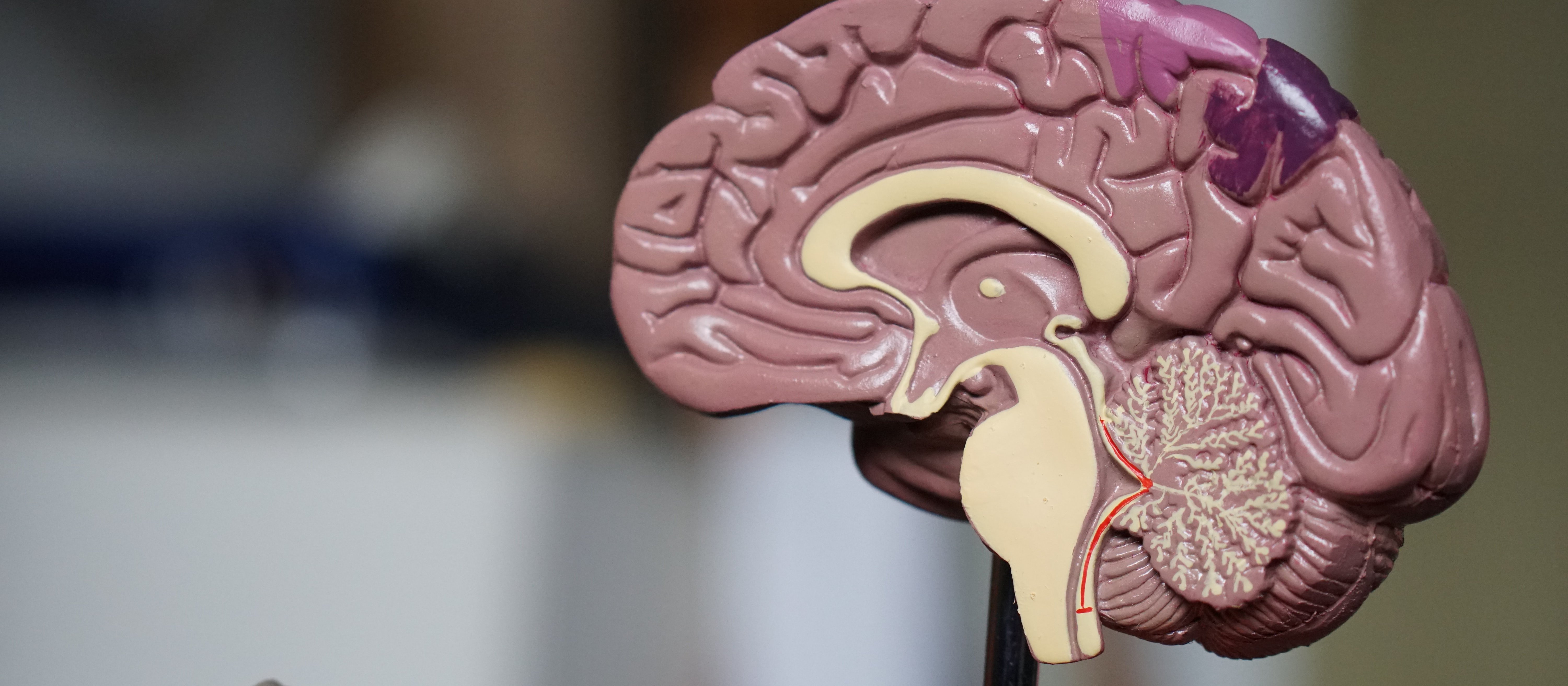 Brain model [Robina Weermeijer on Unsplash] 