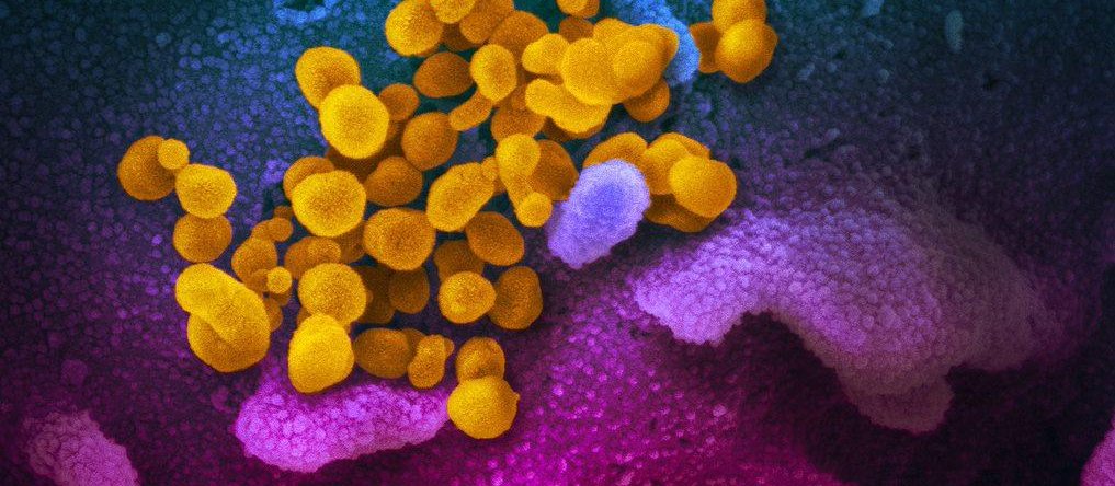 COVID virus