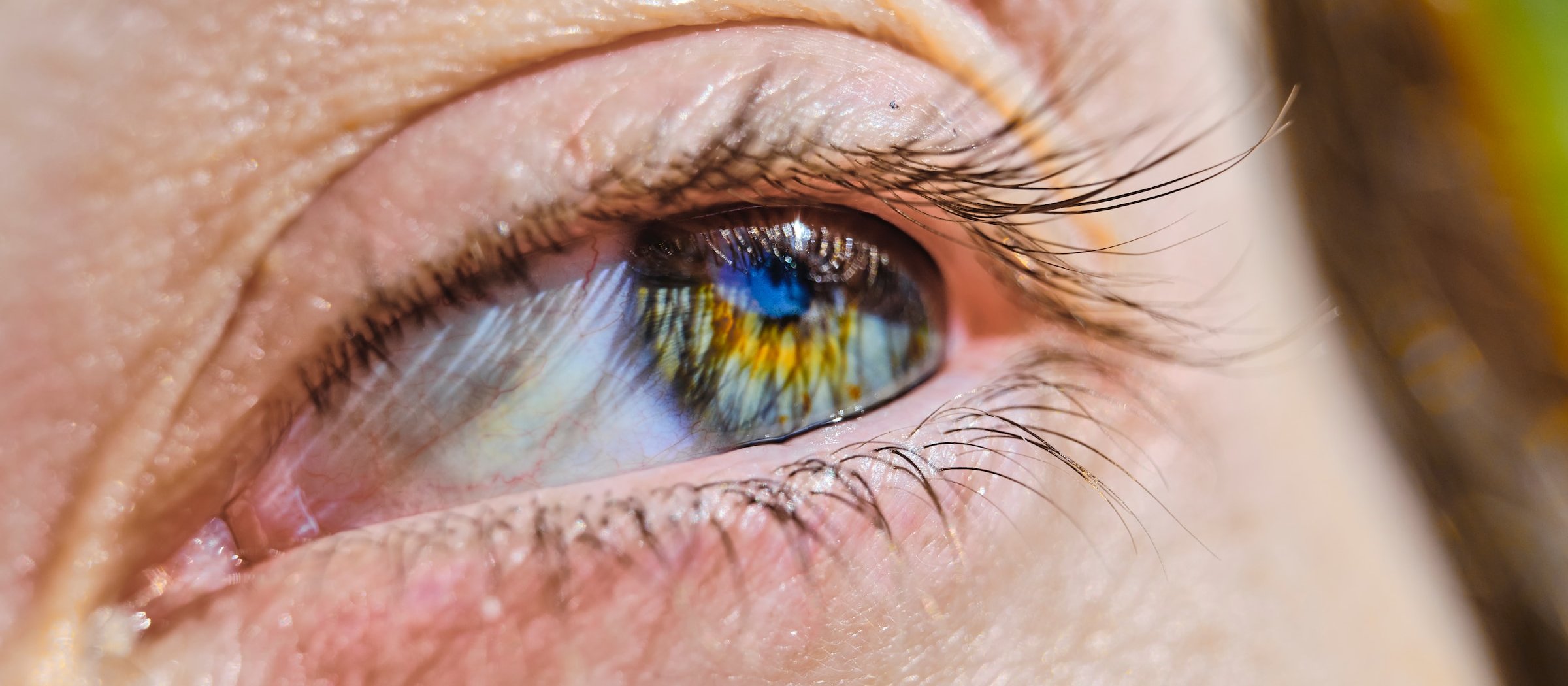 Eye 