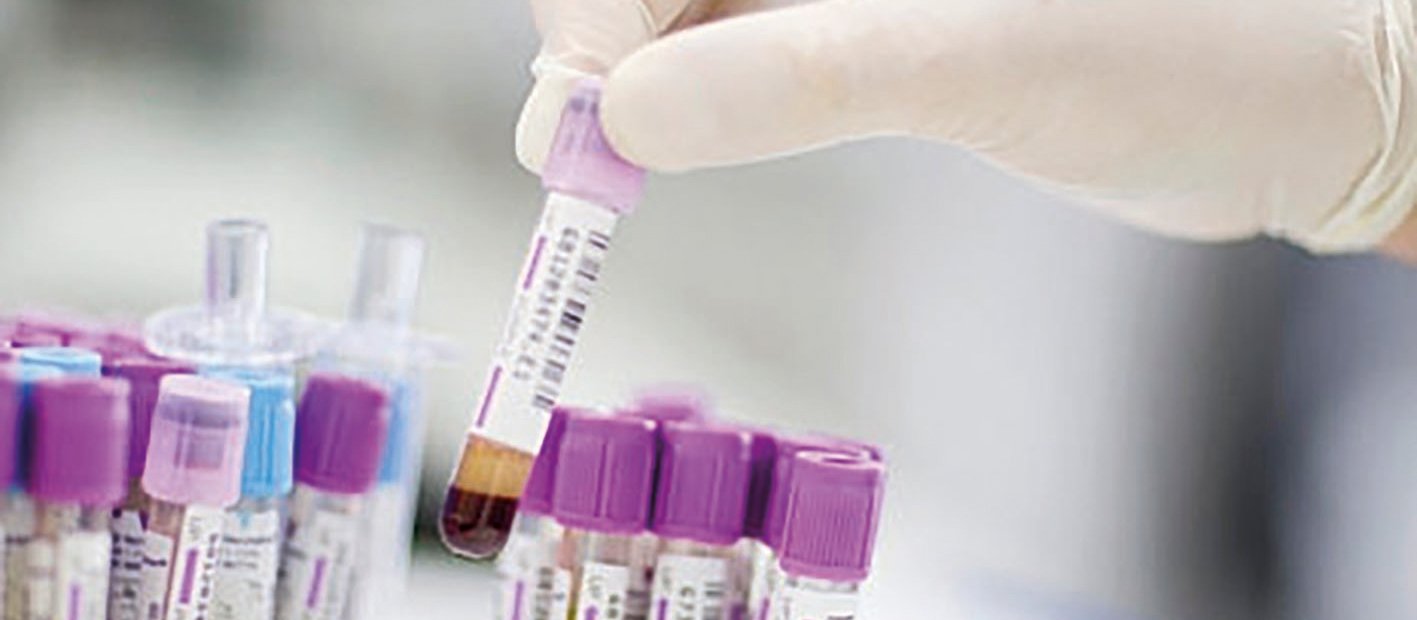 Prostate cancer