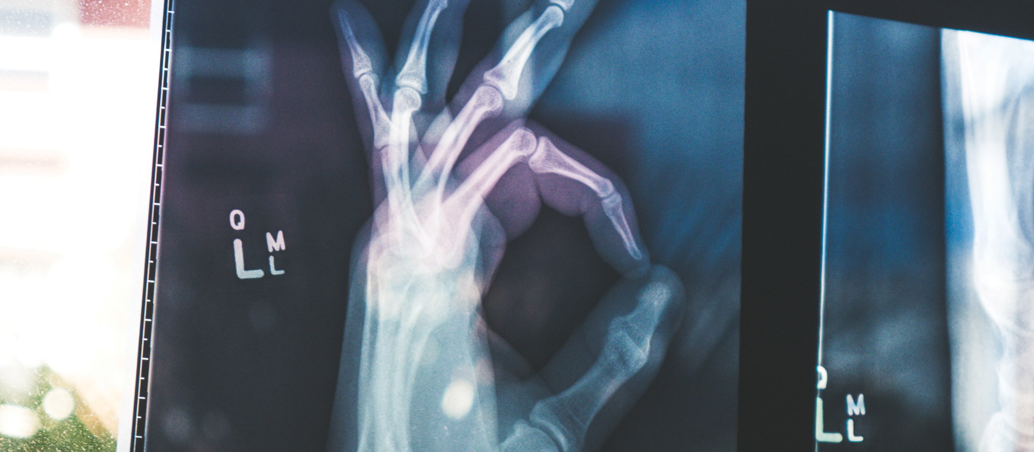 hand scan CR Owen Beard on Unsplash