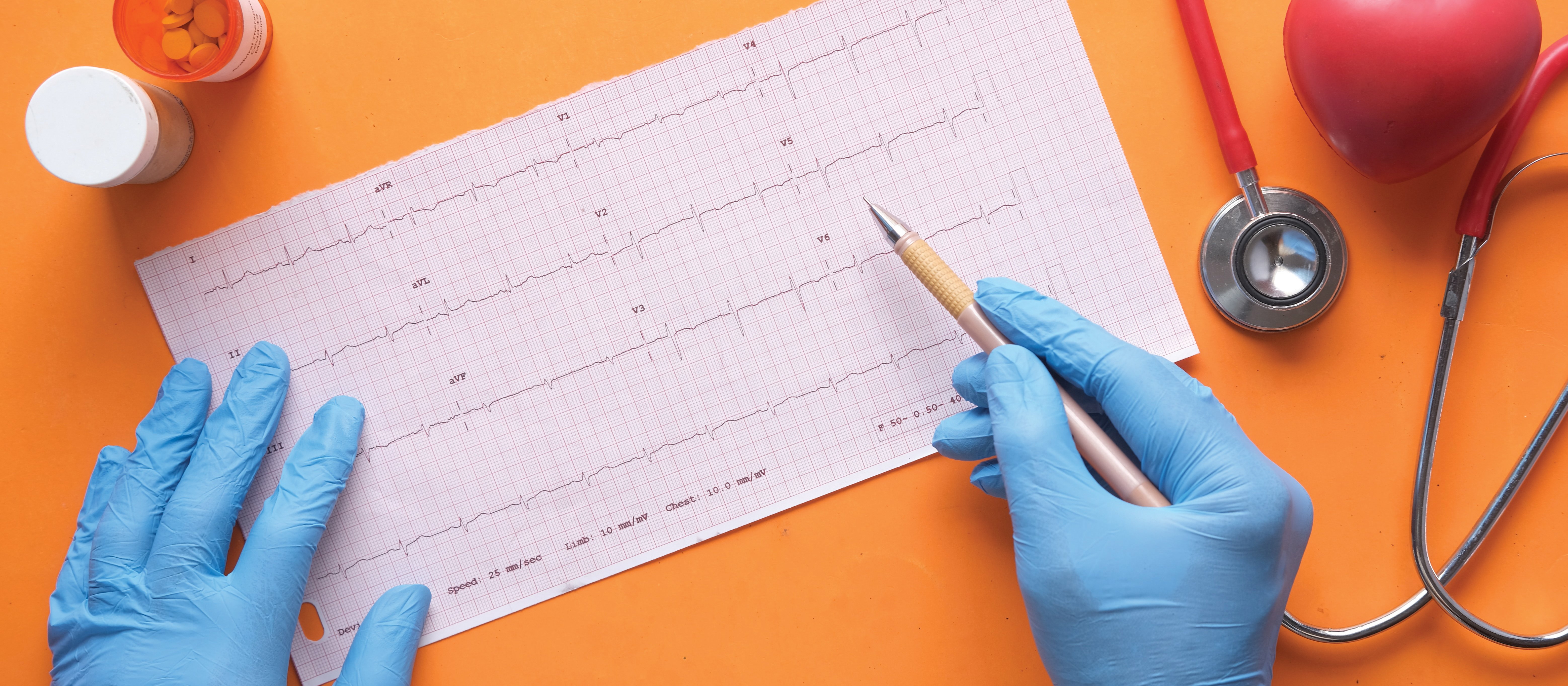 heart attac CR Towfiqu Barbhuiya on Unsplash