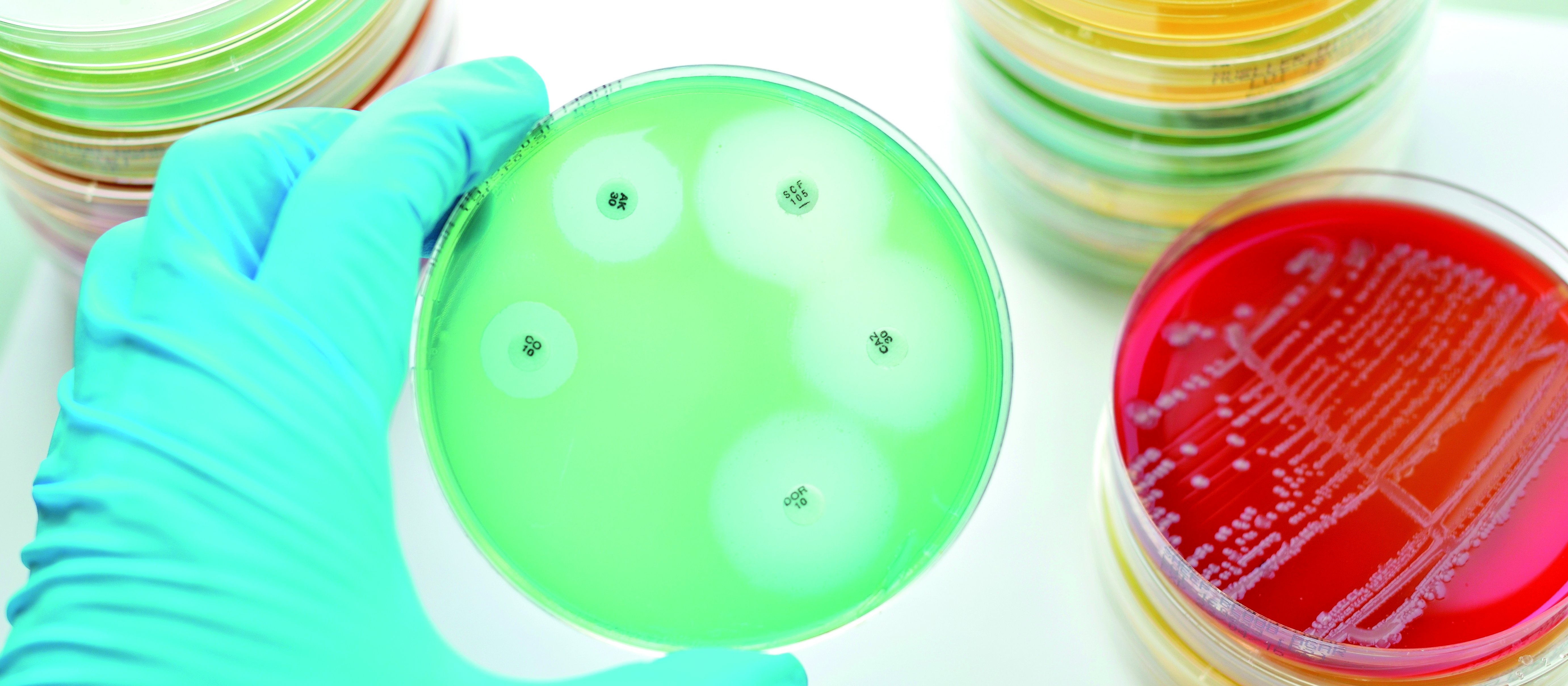 petri dish jarun011 on Adobe Stock